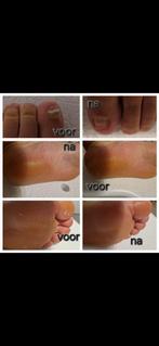 Pedicure bij u thuis!, Boeken, Verzenden