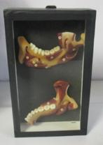 vintage wassen anatomisch model van een gebit 1A, Verzenden