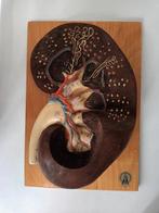 Antiek Medisch Anatomisch model Nier sonneberg lesmateriaal, Ophalen of Verzenden