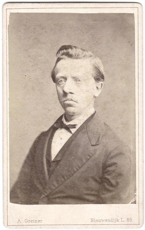 Zeer oude CDV - Man Hazenlip - Foto Greiner Amsterdam, Verzamelen, Foto's en Prenten, Gebruikt, Foto, Overige onderwerpen, Voor 1940