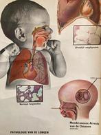 Schoolplaat "Neonatale Ademhalingsmoeilijkheden" en andere., Ophalen of Verzenden, Natuur en Biologie