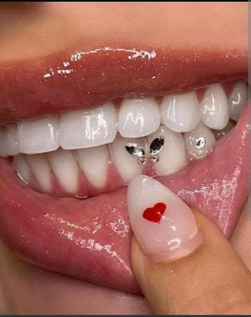 Tooth Gems - Laat je glimlach stralen! beschikbaar voor biedingen