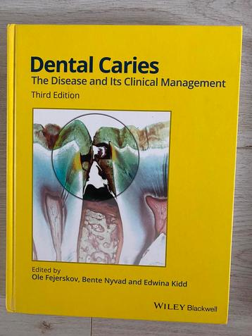 dental caries the disease and its clinical management beschikbaar voor biedingen