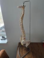 Wervelkolom botmodel. In perfecte staat., Ophalen, Zo goed als nieuw