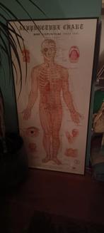 Acupunctuur Poster, Ophalen of Verzenden, Natuur en Biologie