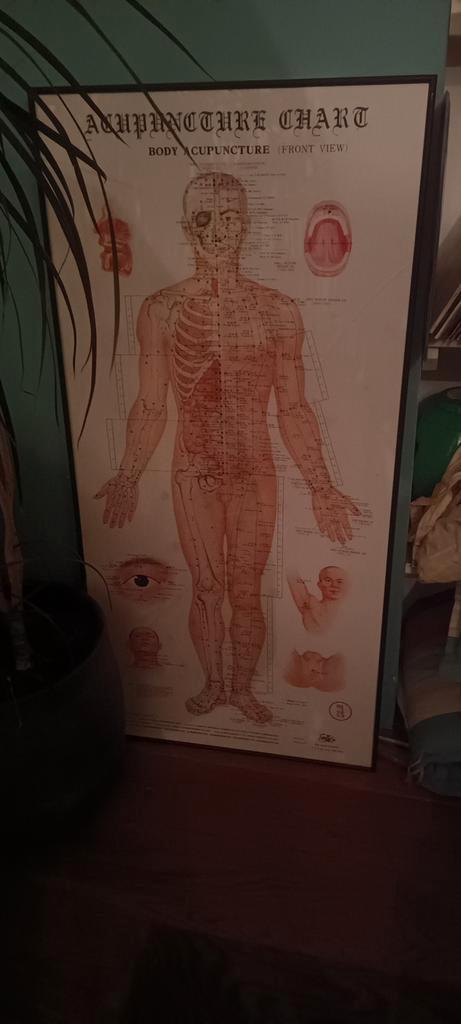 Acupunctuur Poster, Antiek en Kunst, Antiek | Schoolplaten, Natuur en Biologie, Ophalen of Verzenden