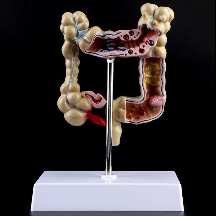 Darmen Menselijk Anatomie Model / Dikke Darm School Medisch, Diversen, Schoolbenodigdheden, Nieuw, Verzenden