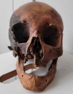 Schedel mens echt preparaat Medisch anatomisch antiek, Ophalen of Verzenden