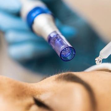Micro needling modellen gezocht voor content beschikbaar voor biedingen