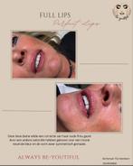 Permanente make-up, Ophalen, Nieuw, Lippen, Overige typen