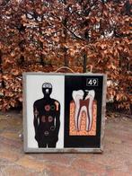 Opticart lichtbak met 16 medische platen, Antiek en Kunst, Antiek | Schoolplaten, Ophalen, Natuur en Biologie