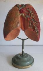 antiek anatomisch model van de longen op standaard 6, Verzenden