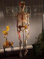 Skelet in de aanbieding, Ophalen