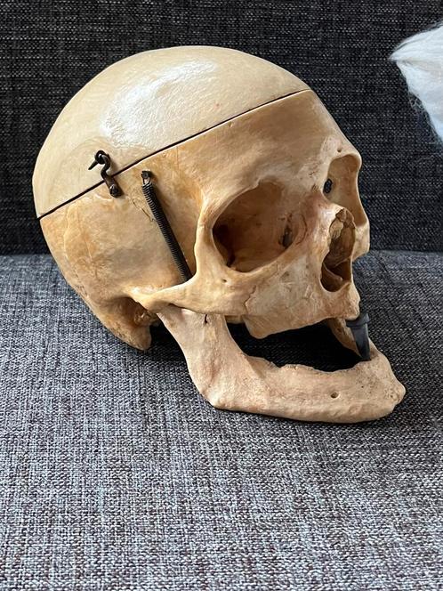 Echte mensenschedel, Verzamelen, Overige Verzamelen, Ophalen