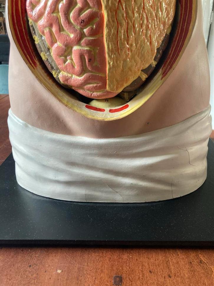 Vintage Anatomisch Torso Model - Menselijke Organen, Verzamelen, Overige Verzamelen, Zo goed als nieuw, Ophalen of Verzenden