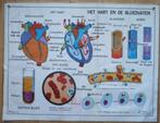 Oude schoolplaat m het hart en de bloedvaten, Ophalen of Verzenden, Natuur en Biologie