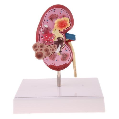 Nier Menselijk Anatomie Model / School Nieren Orgaan Medisch, Diversen, Schoolbenodigdheden, Nieuw, Ophalen of Verzenden