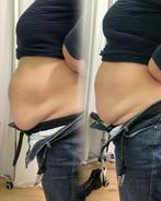 Afslankbehandeling body slimming, Overige uren
