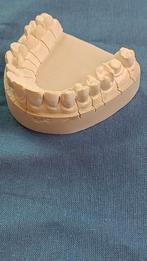 Tandarts preparatie voorbeelden op gipsmodel., Ophalen of Verzenden