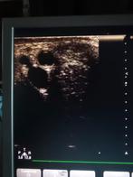 Philips echo apparaat, Ophalen of Verzenden, Gebruikt