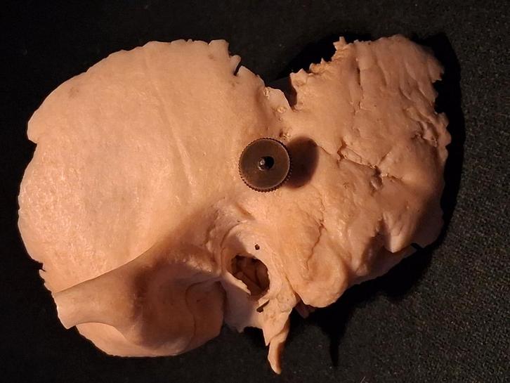 Uitzonderlijk, oud anatomisch preparaat, 3-delig, Antiek en Kunst, Curiosa en Brocante, Ophalen of Verzenden