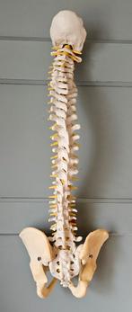 Ruggenwervel model, Ophalen of Verzenden, Zo goed als nieuw