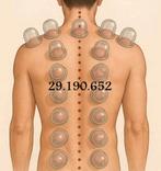 Cupping Hijamma, Ophalen of Verzenden, Apparaat