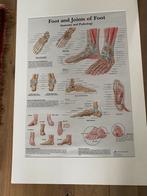 Medische poster anatomie pathologie van de voet in kleur, Rechthoekig Staand, Ophalen of Verzenden, Zo goed als nieuw, Canvas of Doek