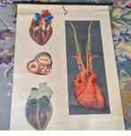 Schoolplaat anatomisch hart anatomie medisch, Ophalen of Verzenden, Natuur en Biologie