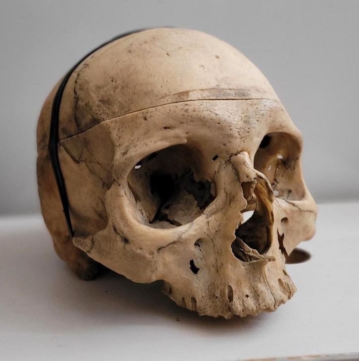 Echte Schedel mens preparaat Medisch anatomisch (2), Verzamelen, Overige Verzamelen, Ophalen of Verzenden