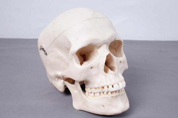K007 Somso QS 7 Anatomisch model van een schedel, Antiek en Kunst, Curiosa en Brocante, Ophalen of Verzenden