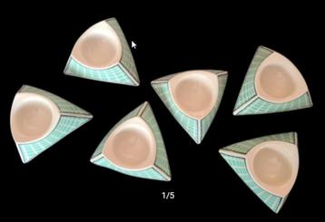Rosenthal Flash One – Set van 6 eierdoppen beschikbaar voor biedingen