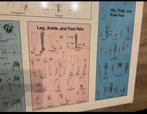 Trigger Point Pain Patterns Wall Charts door David G. Simons, Ophalen, Zo goed als nieuw