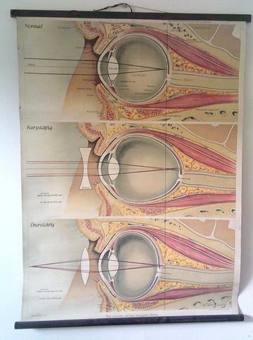 Vintage medische poster van het oog beschikbaar voor biedingen