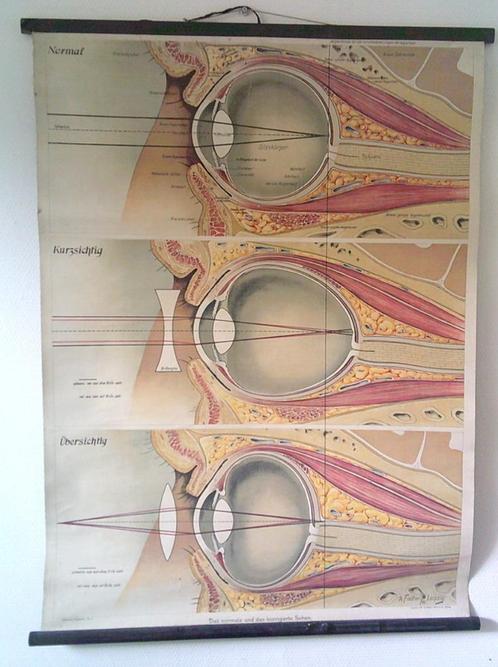 Vintage medische poster van het oog, Verzamelen, Posters, Gebruikt, Overige onderwerpen, Rechthoekig Staand, Canvas of Doek, Ophalen of Verzenden