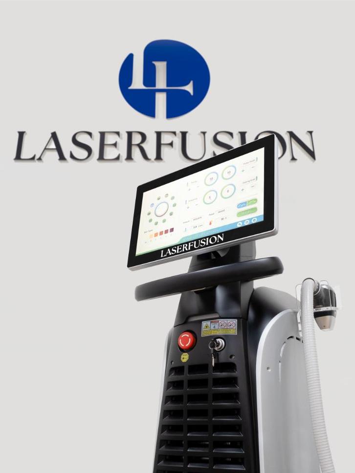 LaserFusion